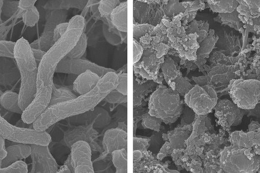 The Gut-Immune Axis: 70% of Your Immune System Lives in Your Digestive Tract