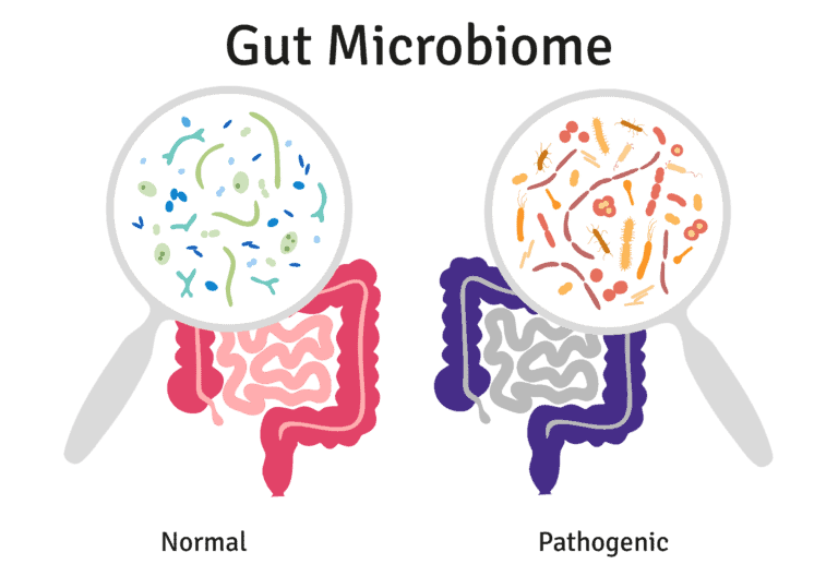 Gut Microbiome - pathogenic vs normal