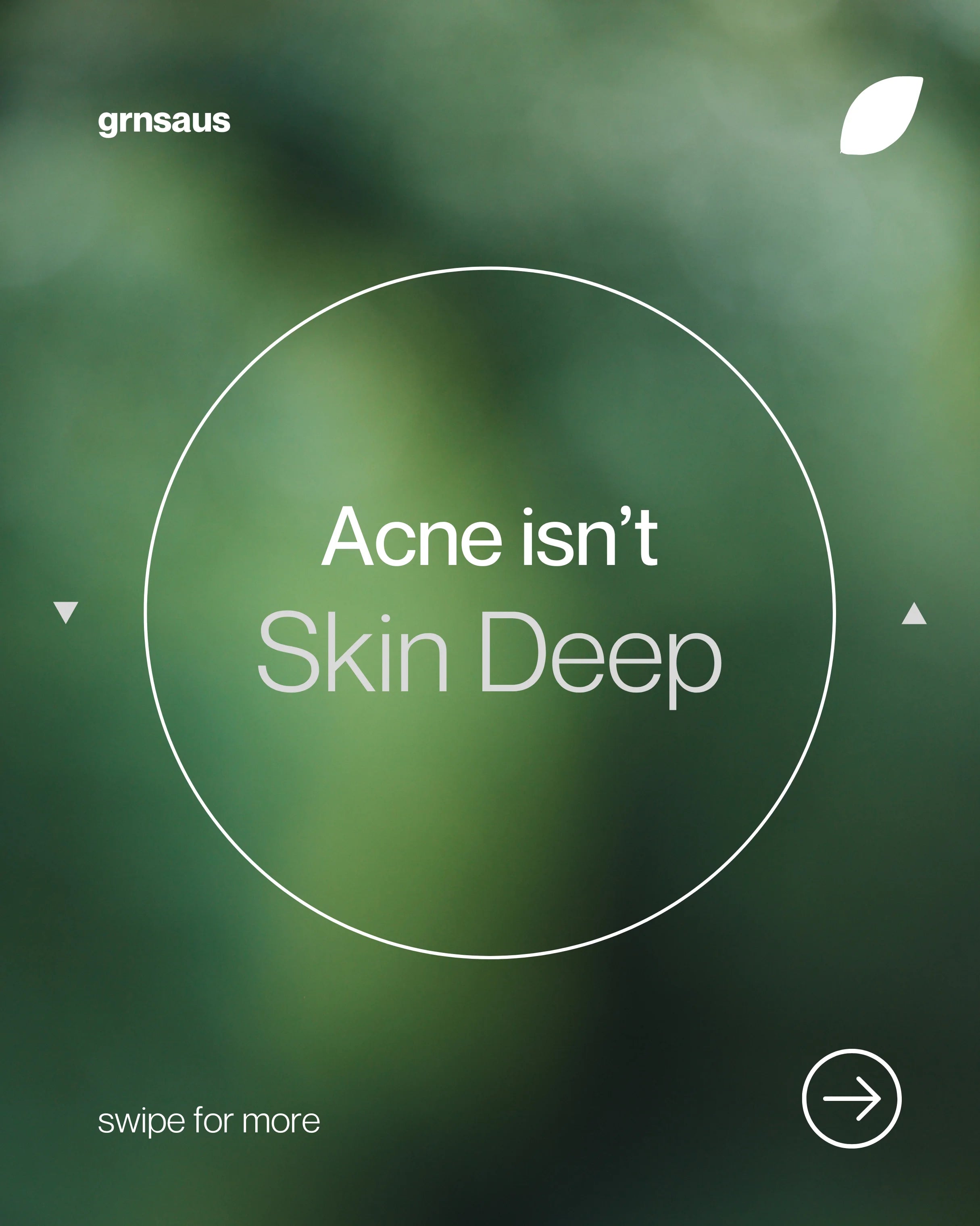 Acne isn't Skin Deep